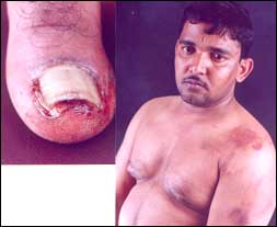 A picture of police atrosity on Bangalore software engineer