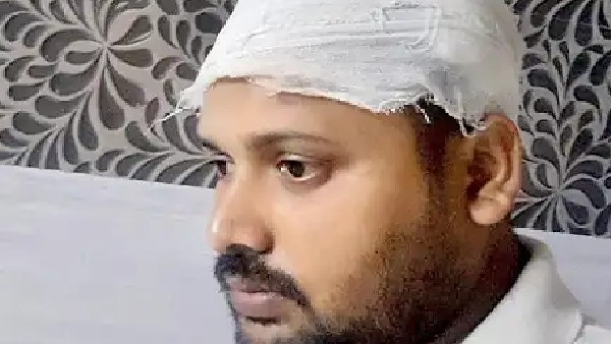 ಗಡಿಯಾರದಿಂದ ತಲೆಗೆ ಹೊಡೆದ ಮ್ಯಾನೇಜರ್