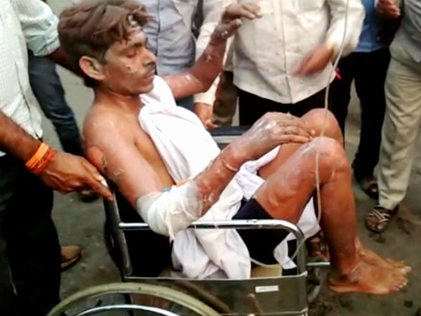 ನೂರಾರು ಮಂದಿ ಕಾರ್ಮಿಕರು, ಅಧಿಕಾರಿಗಳು ಗಾಯಾಳು