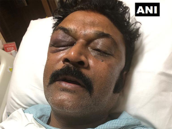 'ಬಂದೂಕು ಕೊಡಿ ಸುಡುತ್ತೇನೆ' ಎಂದರು