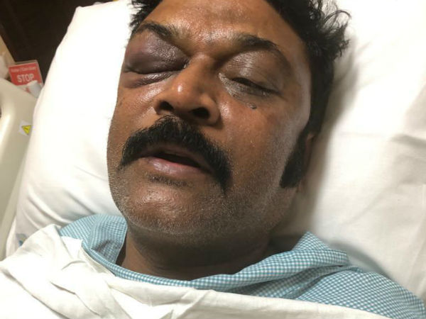 ಆನಂದ್ ಸಿಂಗ್ ಹೇಗಿದ್ದಾರೆ?
