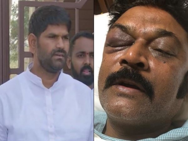 ಆನಂದ್ ಸಿಂಗ್ ಮೇಲೆ ಹಲ್ಲೆ ನಡೆಸಿದ್ದ ಶಾಸಕ