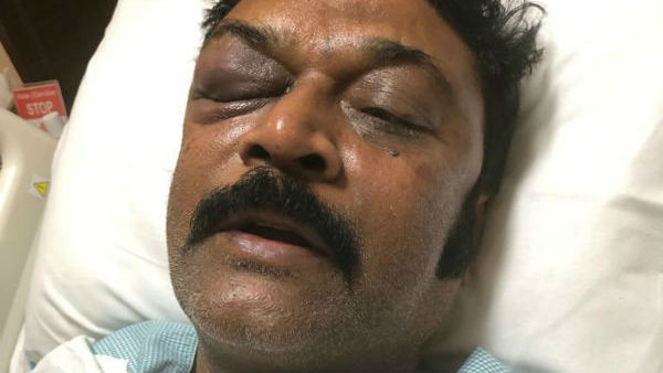 ಆನಂದ್ ಸಿಂಗ್ ಗಾಯಗೊಂಡಿದ್ದರು
