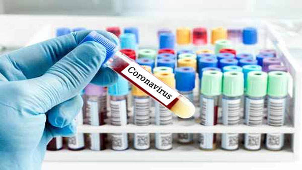 HIV ಕೂಡ ಹೋಗಿಲ್ಲ ನಮ್ಮ ಮಧ್ಯೆಯೇ ಇದೆ