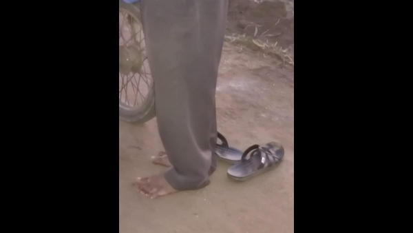ಎಷ್ಟೇ ಹೇಳಿದರೂ ಚಪ್ಪಲಿ ಹಾಕಿಕೊಳ್ಳಲಿಲ್ಲ