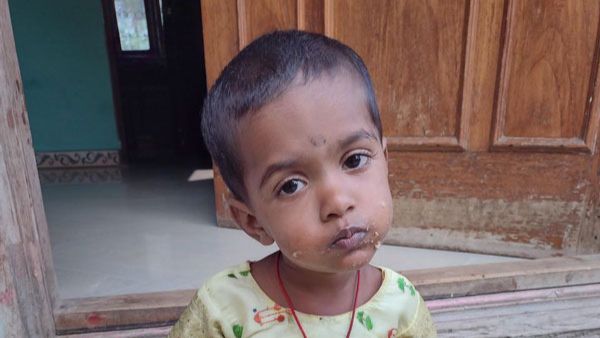 ಚಿಕಿತ್ಸೆಗೆ ತಗುಲುವ ವೆಚ್ಚ ಎಷ್ಟು?
