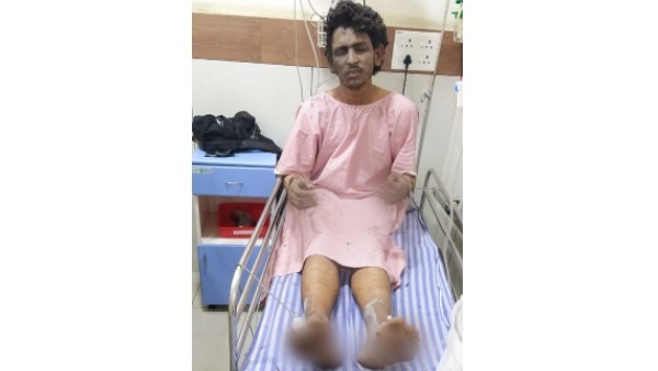 Mangaluru blast Suspect Shariq Learnt to Make Bombs on Messaging Platforms Mangaluru blast Suspect Shariq Learnt to Make Bombs on Messaging Platforms