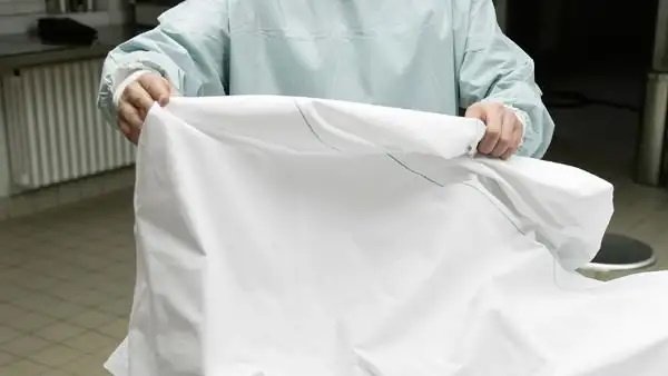 Snake came out of the dead body during the postmortem examination Snake came out of the dead body during the postmortem examination