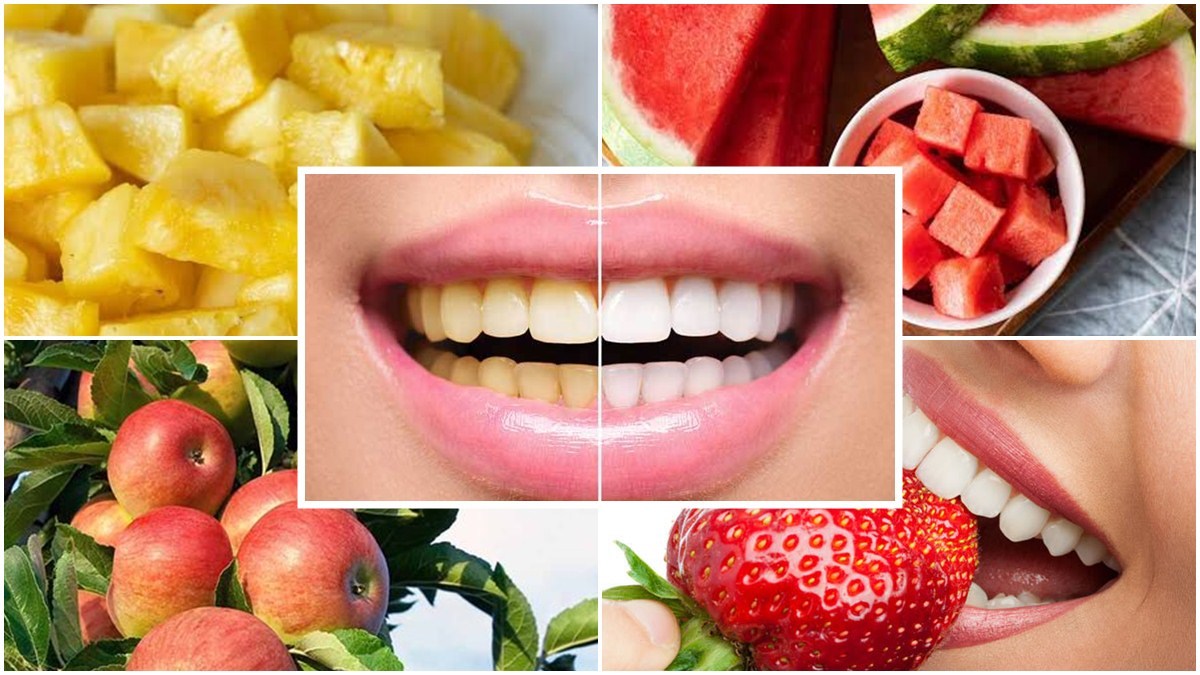 Dental Care Tips ಹಲ್ಲಿನ ಆರೋಗ್ಯ ಕಾಪಾಡುವ ಹಣ್ಣುಗಳು ಇವು... ತಿಂದು ನೋಡಿ