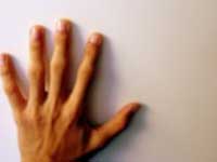 What a metamorphosis?